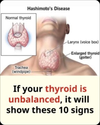 The 10 Silent Signs Your Thyroid Is Failing You (And Why You NEED to Act Fast!)