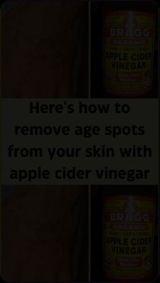 Age Spots Vanish! The #1 Apple Cider Vinegar Hack for Clear Skin (Plus 5 MORE Natural Remedies You Need to Know)