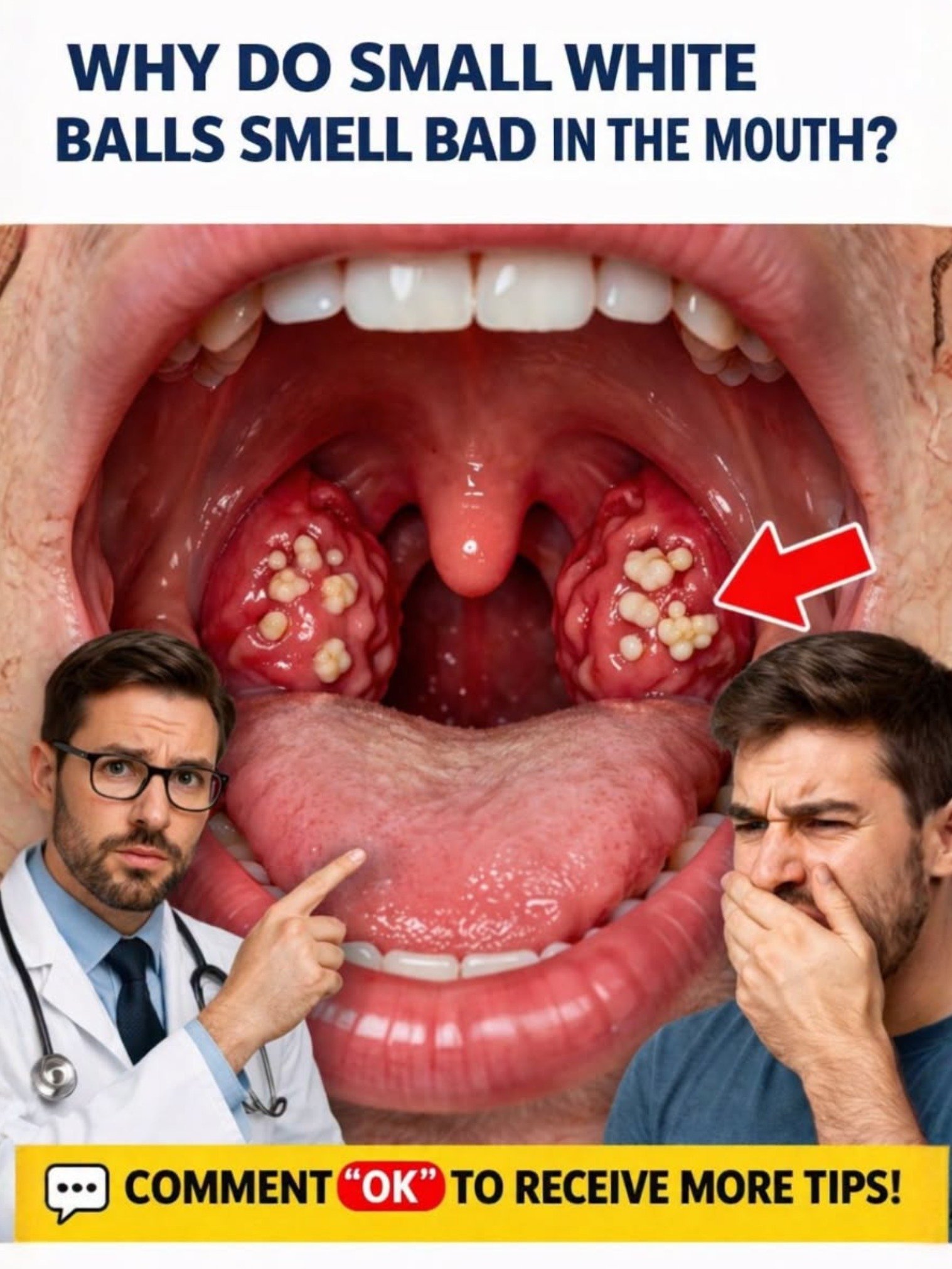 STOP Ignoring Them! The REAL Reason You Have Those Smelly White Lumps in Your Mouth (And How to Fix It!)