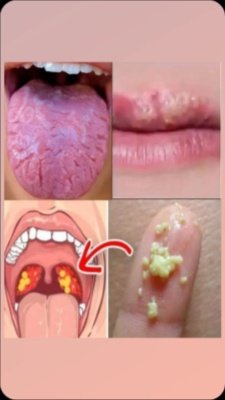 The Silent Signals Your Mouth Is Crying for Help (And 5 Easy Fixes You Can Start Today!)