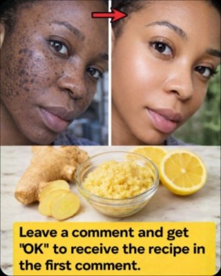 STOP Scrolling! These 2 Kitchen Staples Could Be Your Secret to Brighter, Even Skin (Potatoes & Ginger REVEALED)