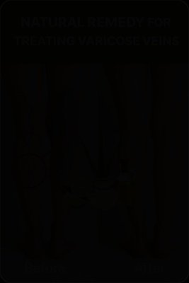 The Ancient 3-Ingredient Secret Your Grandma Knew For Soothing Varicose Veins (And Why You Need It Now!)