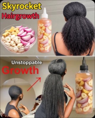 The Shocking Indian Secret to Rapid Hair Growth: Your Kitchen Holds the Cure for Baldness!