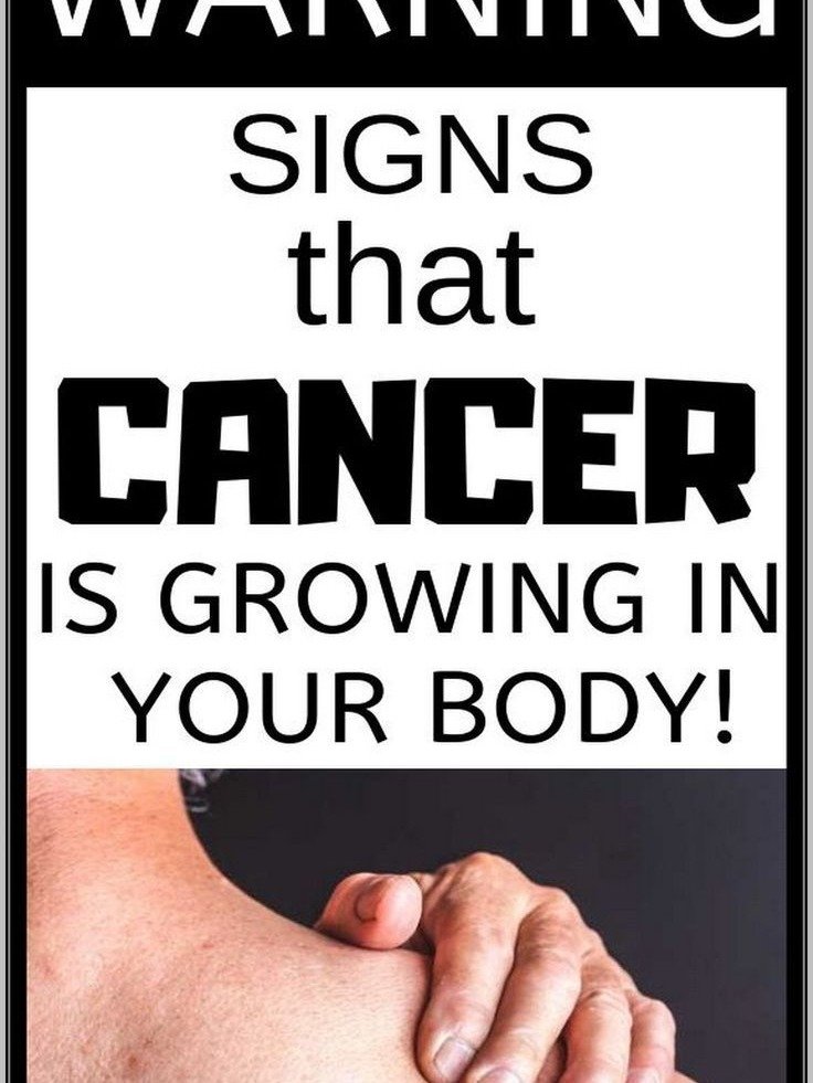 9 CRITICAL Warning Signs Your Body Is Giving You About Cancer (Don't Miss These Life-Saving Clues!)