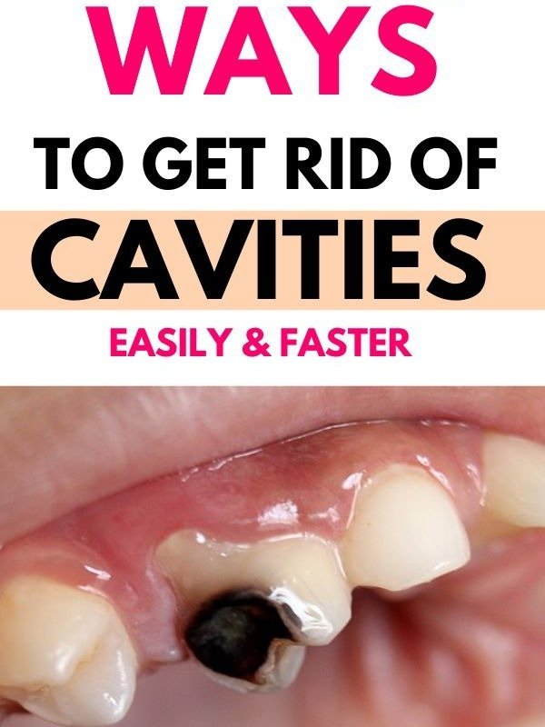 Cavity Emergency? 6 Shocking Home Hacks to Stop Pain & Halt Decay FAST (Before Your Dentist Visit!)