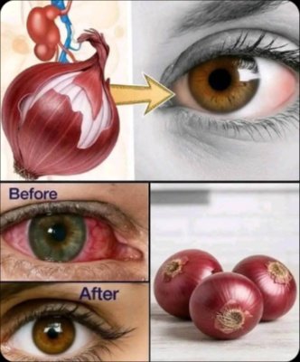 STOP! Before You Put Onion Juice in Your Eyes, Read This.