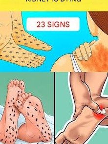 Your Kidneys Are Sending SOS Signals! 23 Critical Warning Signs You CANNOT Afford to Miss