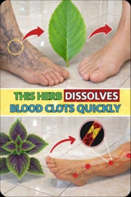 STOP Ignoring Your Legs! 6 Powerful Herbs That Could TRANSFORM Your Circulation After 40
