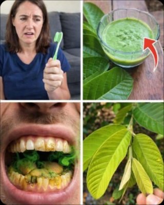 The 3 Guava Leaf Secrets for a Sparkling Smile Your Dentist Might Not Tell You (Plus the #1 Mistake Everyone Makes!)