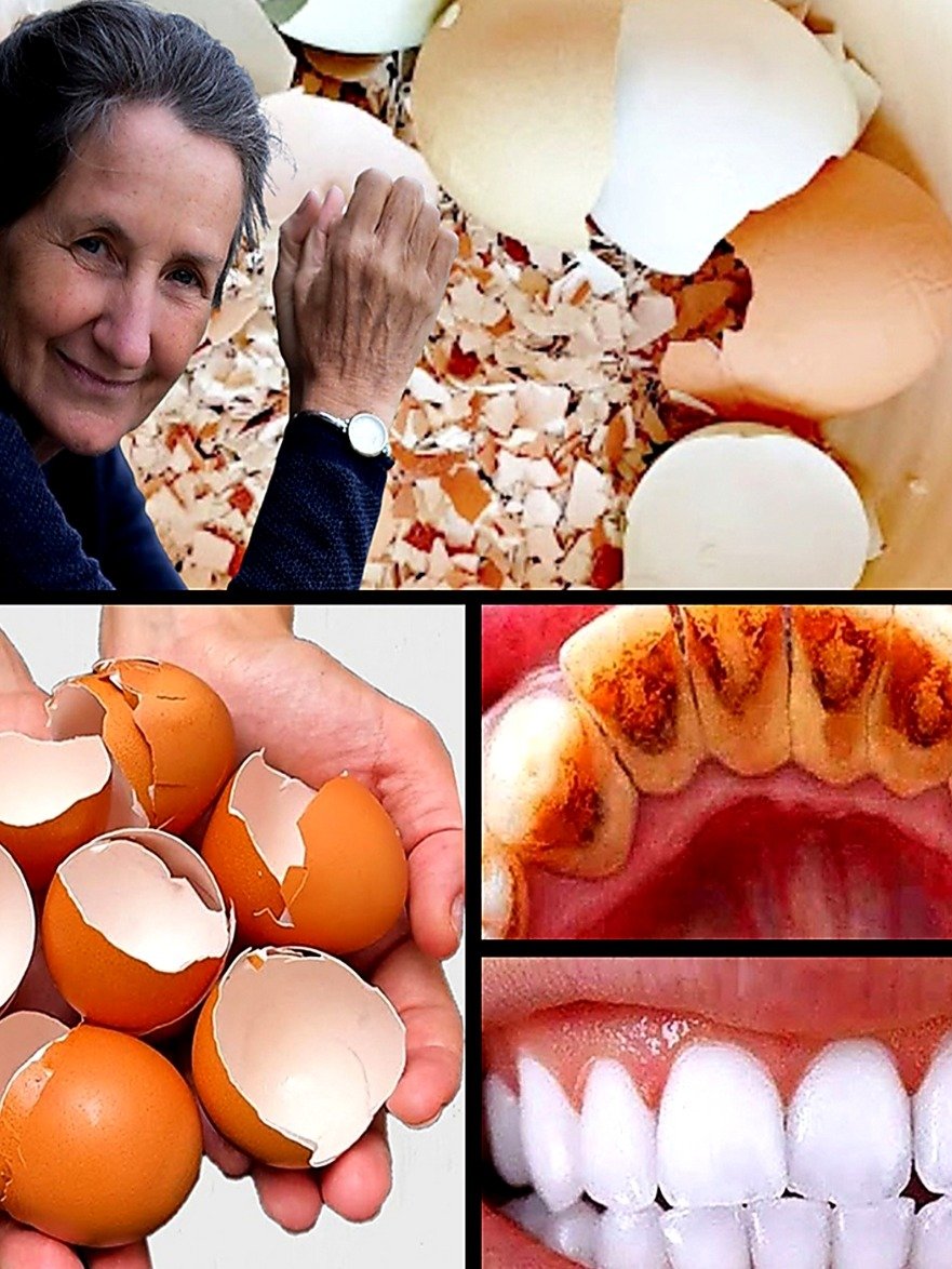 STOP! You're Throwing Away the Secret to Pearl White Teeth (This Natural Hack Works Fast!)