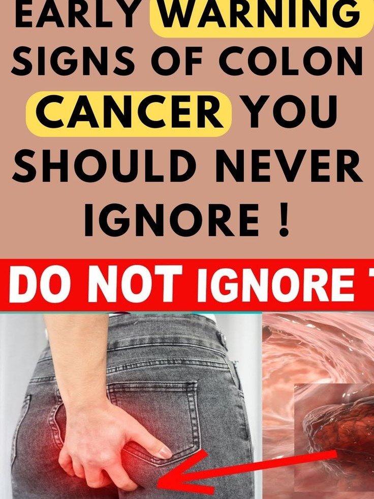 Your Body's Secret Signals: 6 Colon Cancer Warnings You CAN'T Afford to Miss