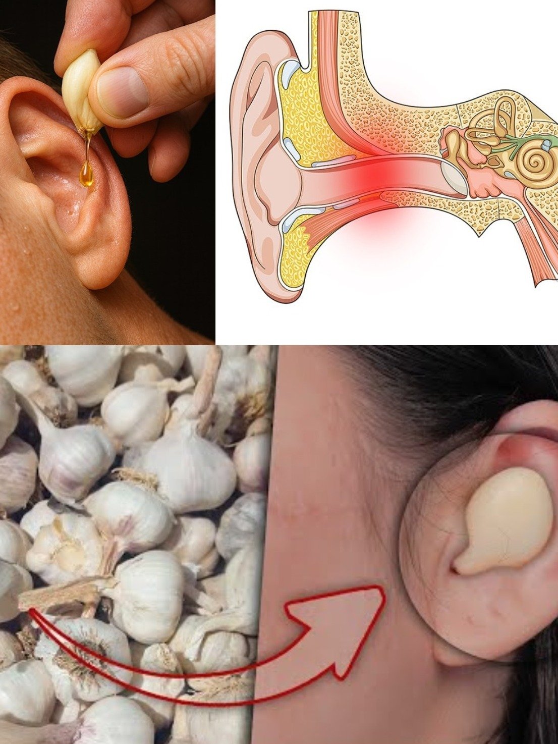 Suffering from Ear Discomfort? The Ancient Garlic Secret That Could Bring Natural Relief (You Won't Believe It!)
