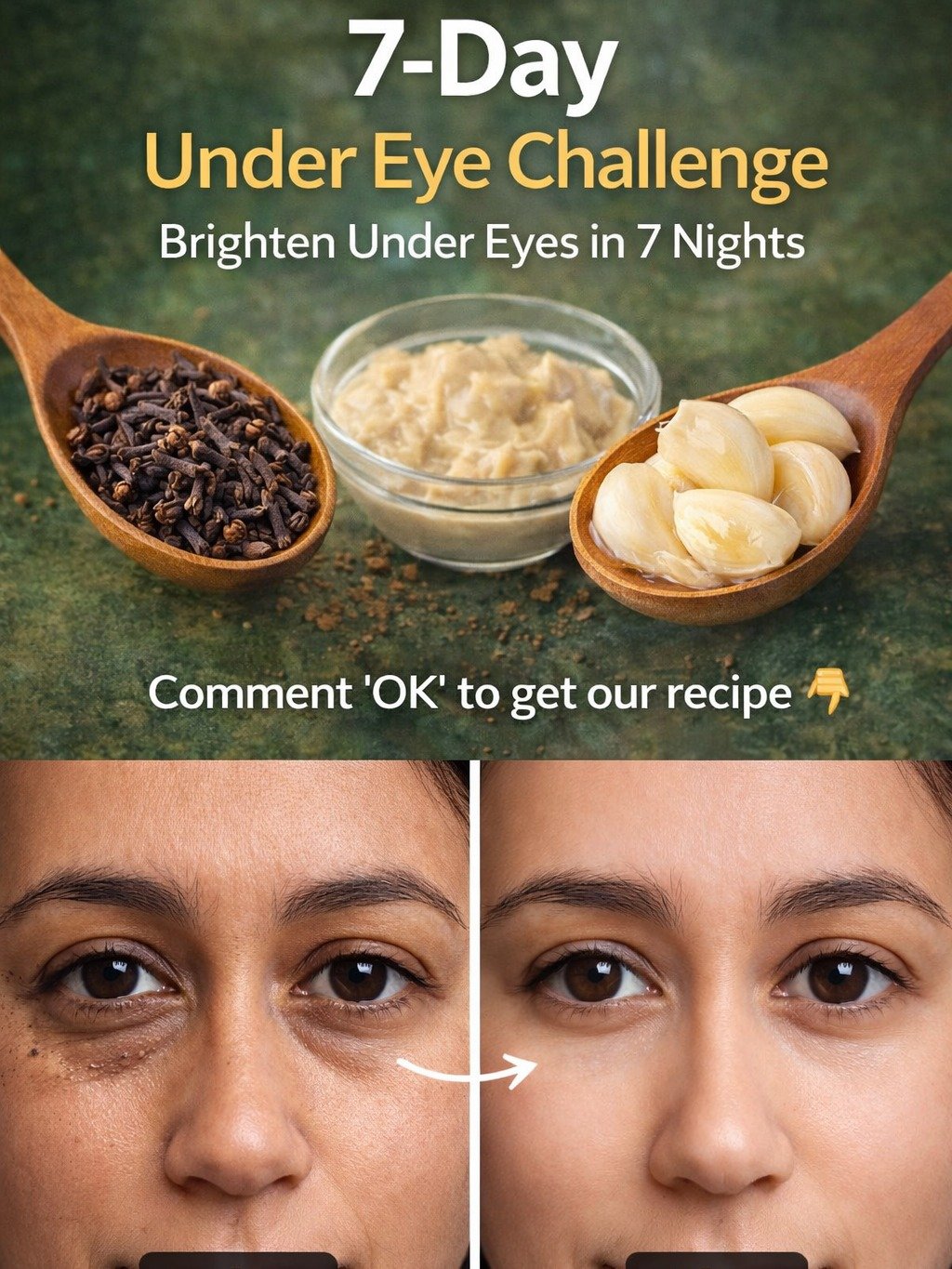 The 7-Day Dark Circle Challenge: Unlock Brighter, Fresher Eyes Naturally (Before & Afters Will Shock You!)