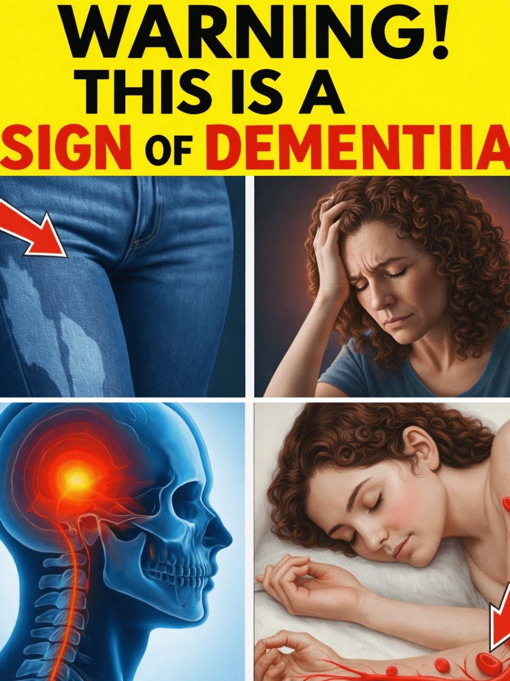 The 9 Sneaky Early Signs of Dementia Almost NO ONE Spots (Plus 13 Critical Symptoms You Can't Afford to Miss)
