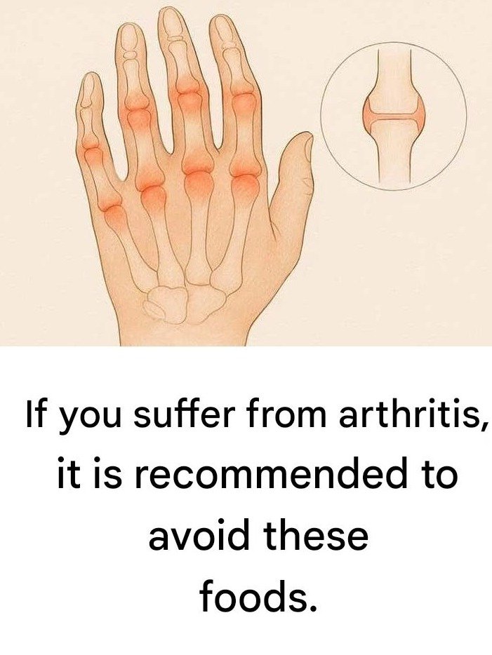 Arthritis Pain Holding You Back? These 6 Foods Are Secretly Fueling Your Inflammation – Ditch Them NOW!