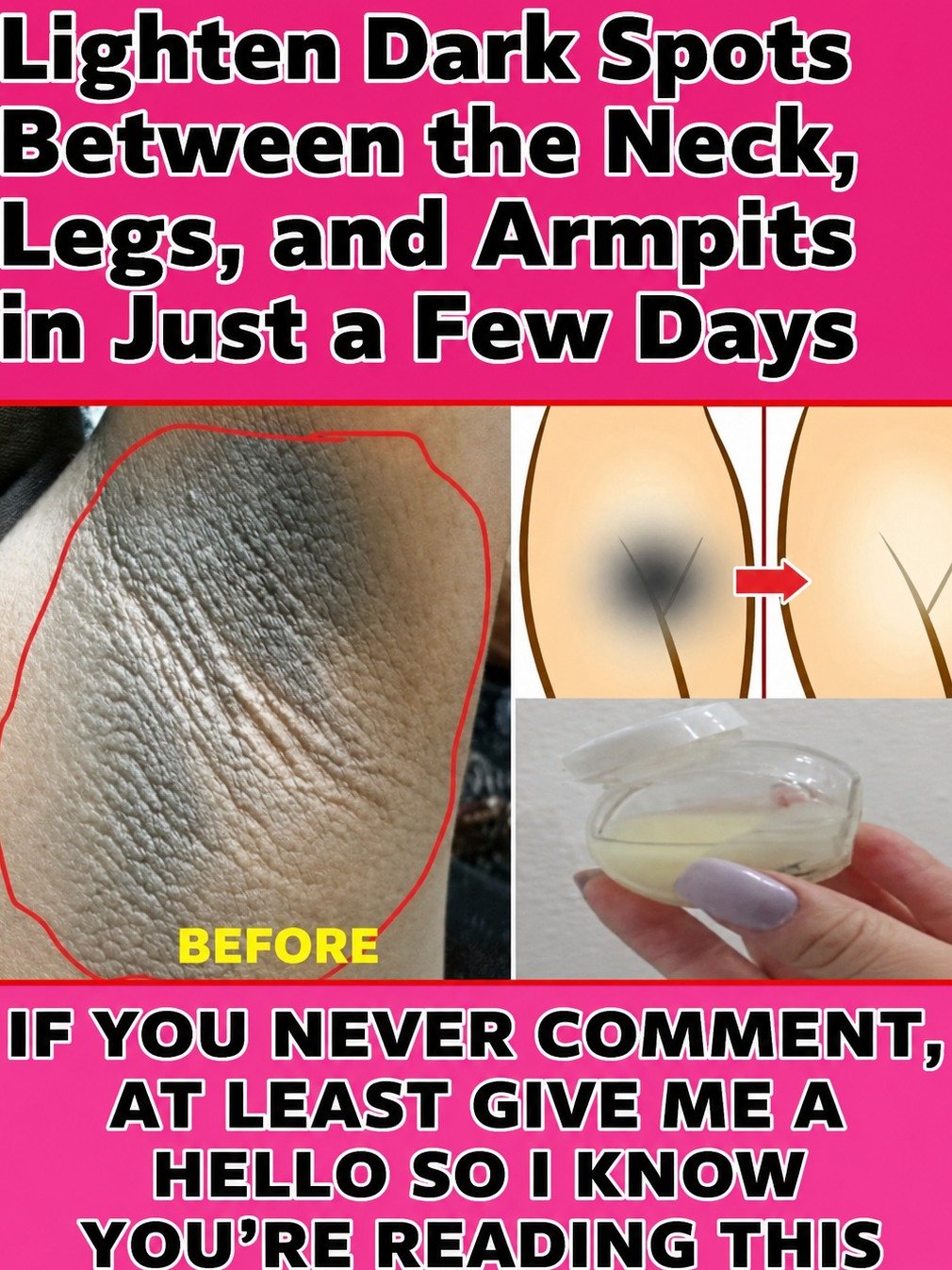 Dark Inner Thighs? Unlock Brighter Skin with These 2 Shocking Kitchen Secrets (You Won't Believe the Results!)