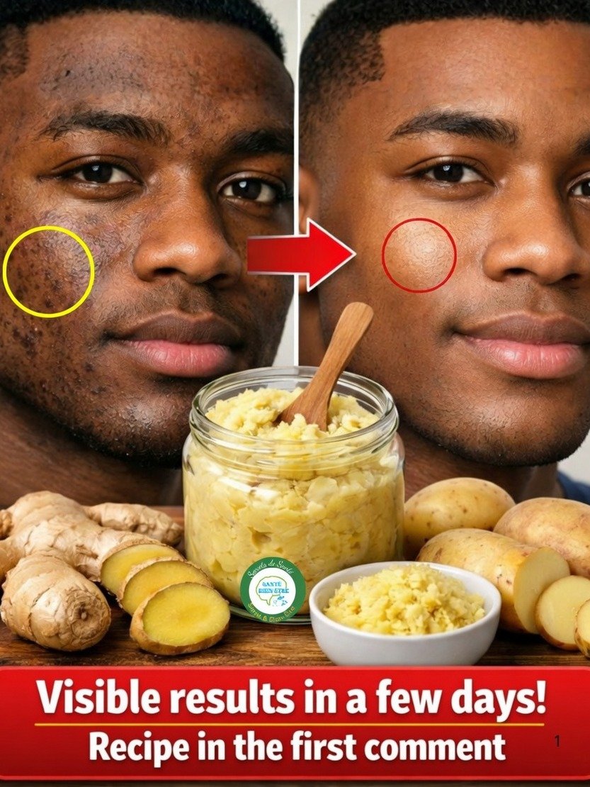 The Viral Kitchen Secret: Can Potatoes & Ginger REALLY Give You Radiant, Even Skin?