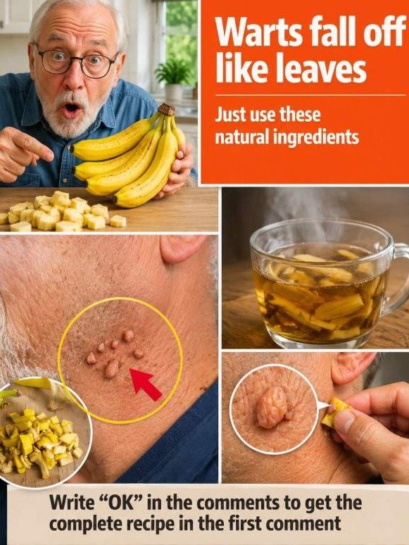 The Shocking Kitchen Secret: Warts Fall Off Like Leaves When Banana Peel Hits This Unexpected Trigger