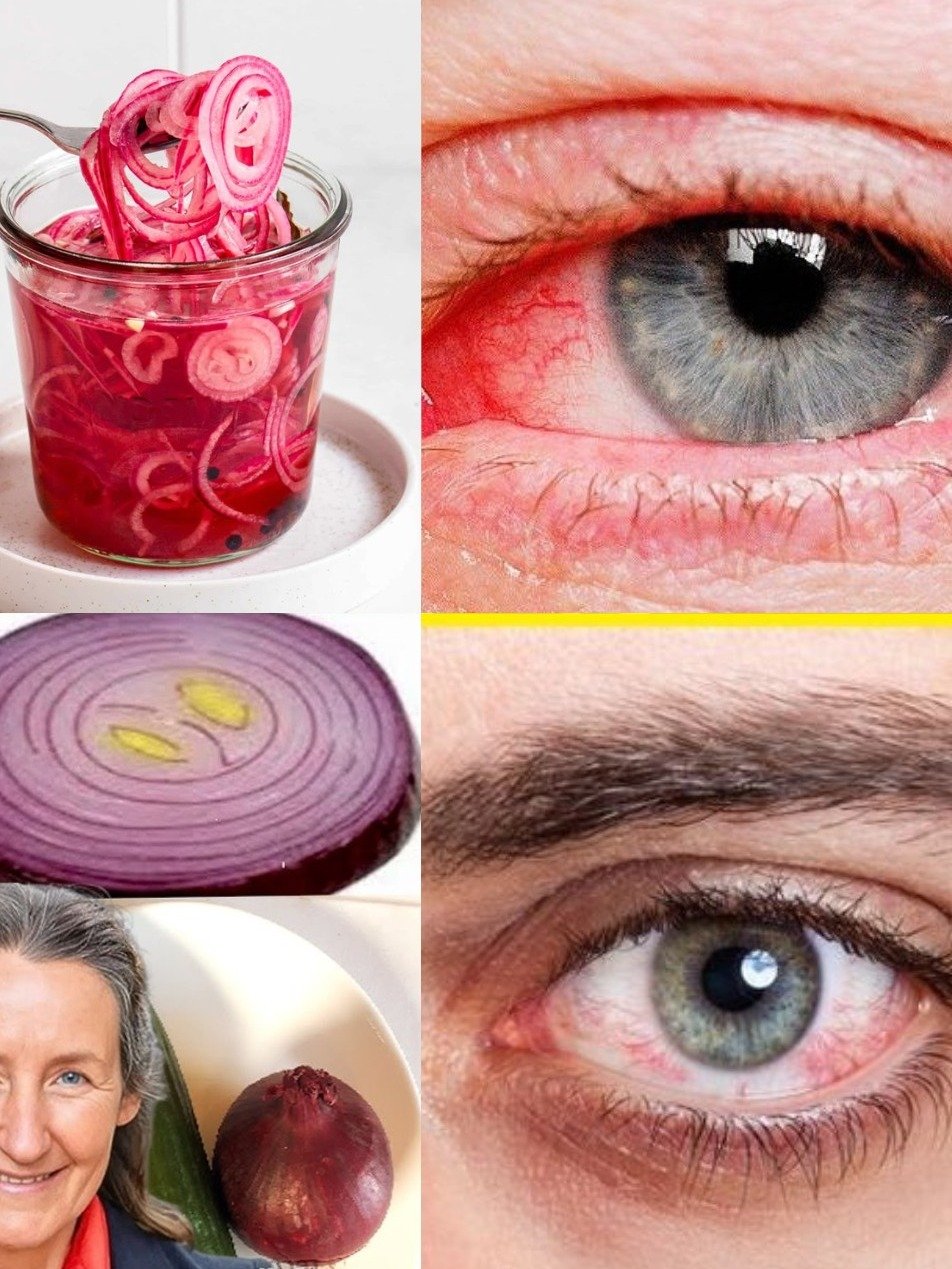 Viral Buzz: Can Onion Juice REALLY Transform Your Eyesight in Just 5 Days? The Shocking Truth Revealed!