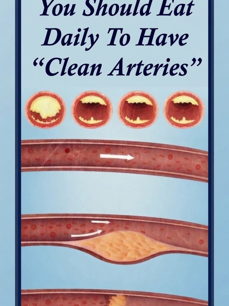 The ONLY 12 Foods You Need to Eat Daily for Naturally Cleaned Arteries (You'll Wish You Knew Sooner!)