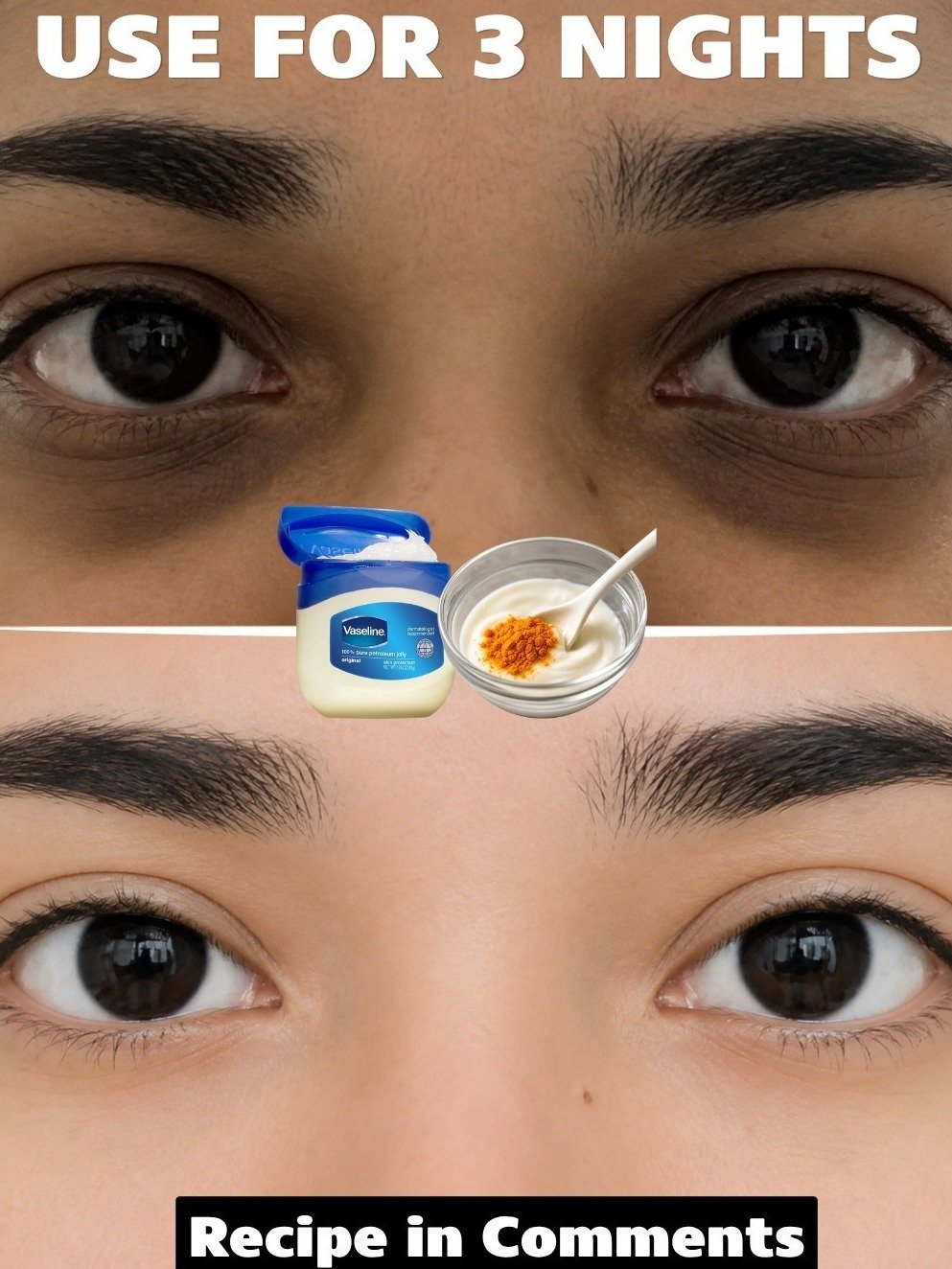 Unbelievable! This 10-Minute DIY Vaseline & Turmeric Serum Erases Dark Circles & Reveals Brighter Eyes FAST