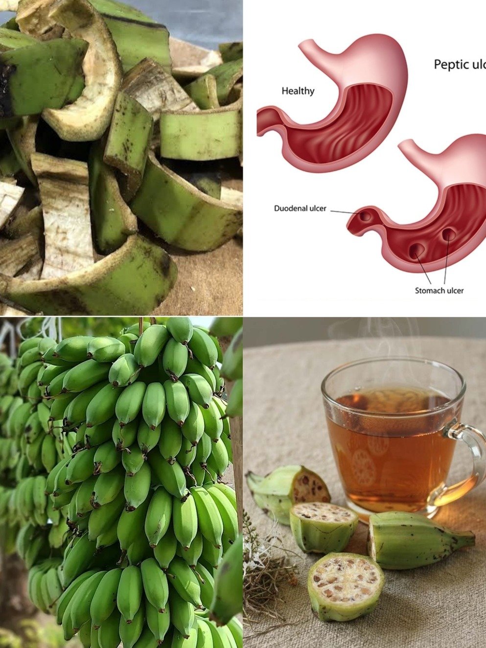 The Forgotten Natural Cure: How This Humble Peel Can FINALLY End Your Stomach Ulcer & H. pylori Misery!