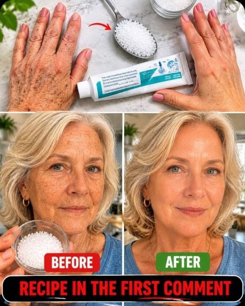 The Unbelievable Colgate + Baking Soda Hack That Resets Rough Hands & Arms – See the Instant Transformation!
