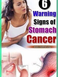 STOP Scrolling! 6 Stomach Cancer Signs You're Ignoring That Could Save Your Life