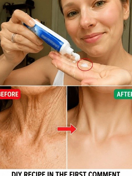 Unlock Youthful Hands & Arms: The Viral 3-Ingredient Mask Erasing Wrinkles and Spots Naturally!