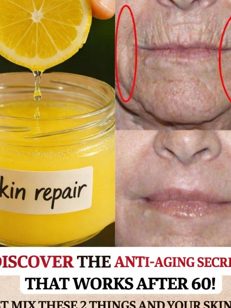 The Viral Vaseline & Lemon Hack: Uncover Brighter, Softer Skin Overnight (Don't Miss This!)