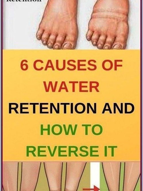 Bloated & Puffy? Uncover the 6 SHOCKING Reasons Your Body Holds Water (and How to DRAIN It Naturally!)