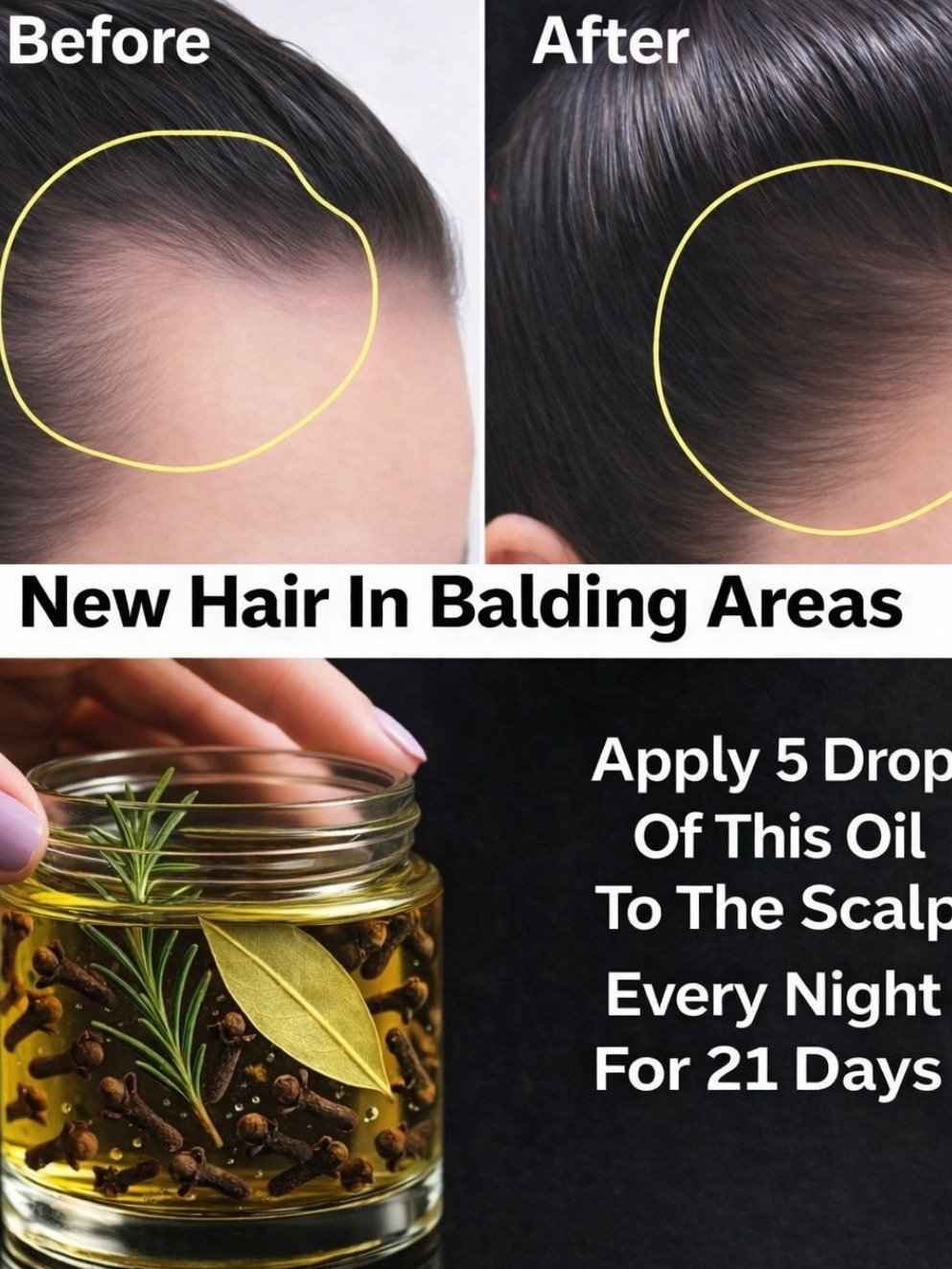 The Viral 21-Day Hair Growth Secret: How Rosemary & Clove Oil Can End Thinning Hair & Revive Your Edges!