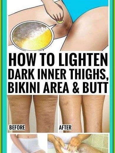 Unlock Brighter Skin: The 2 Shockingly Simple Home Remedies for Dark Underarms & Bikini Area You NEED to Try NOW!