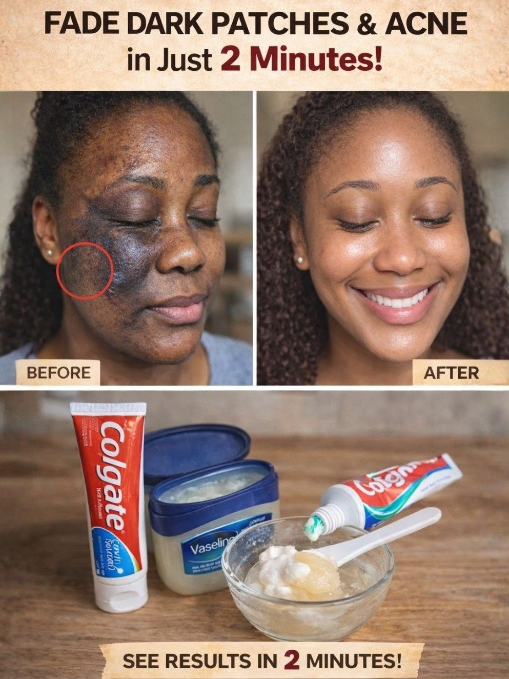 The Viral Colgate & Vaseline Face Hack: I Tried It, And This Is The Shocking Truth You NEED To Know!