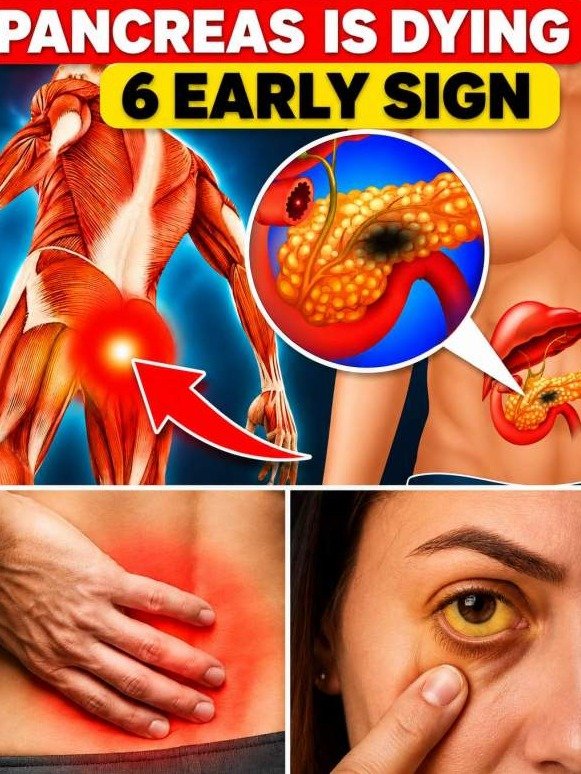 6 Urgent Pancreatic Cancer Warnings You're Probably Missing (Don't Let It Be Too Late)
