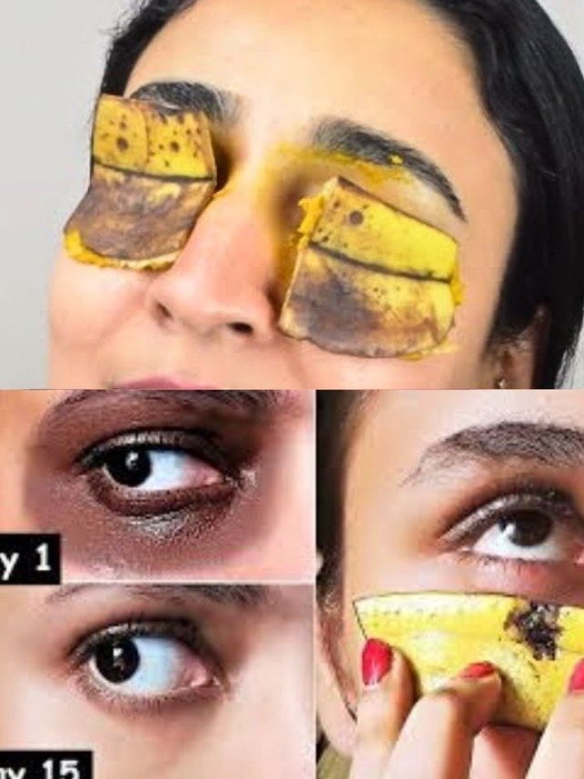 The FREE Skincare Secret That Vanished My Dark Circles in 7 Days (Banana Peel Exposed!)