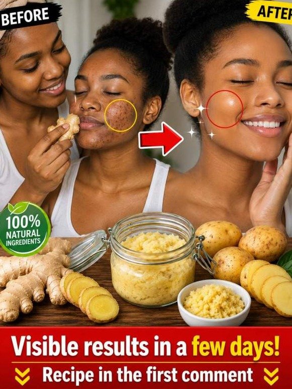 The Hidden Truth About Facial Spots: Why Potatoes & Ginger Are Your Secret Weapon (And How to Use Them RIGHT)