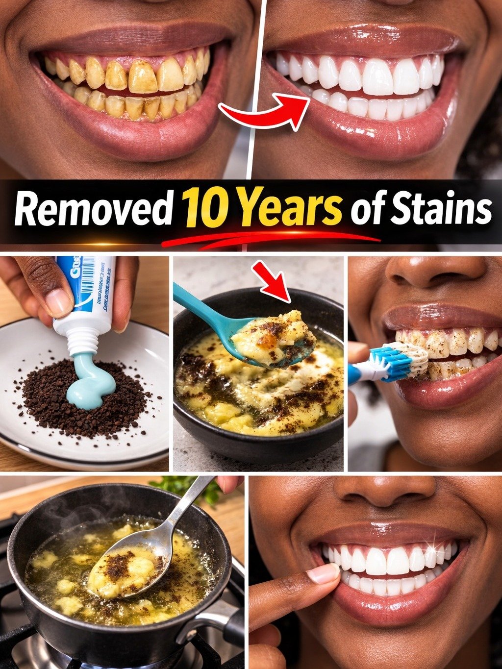 The 2-Minute Coffee & Toothpaste Hack That Promises Whiter Teeth: Is It a Miracle or a Mistake?