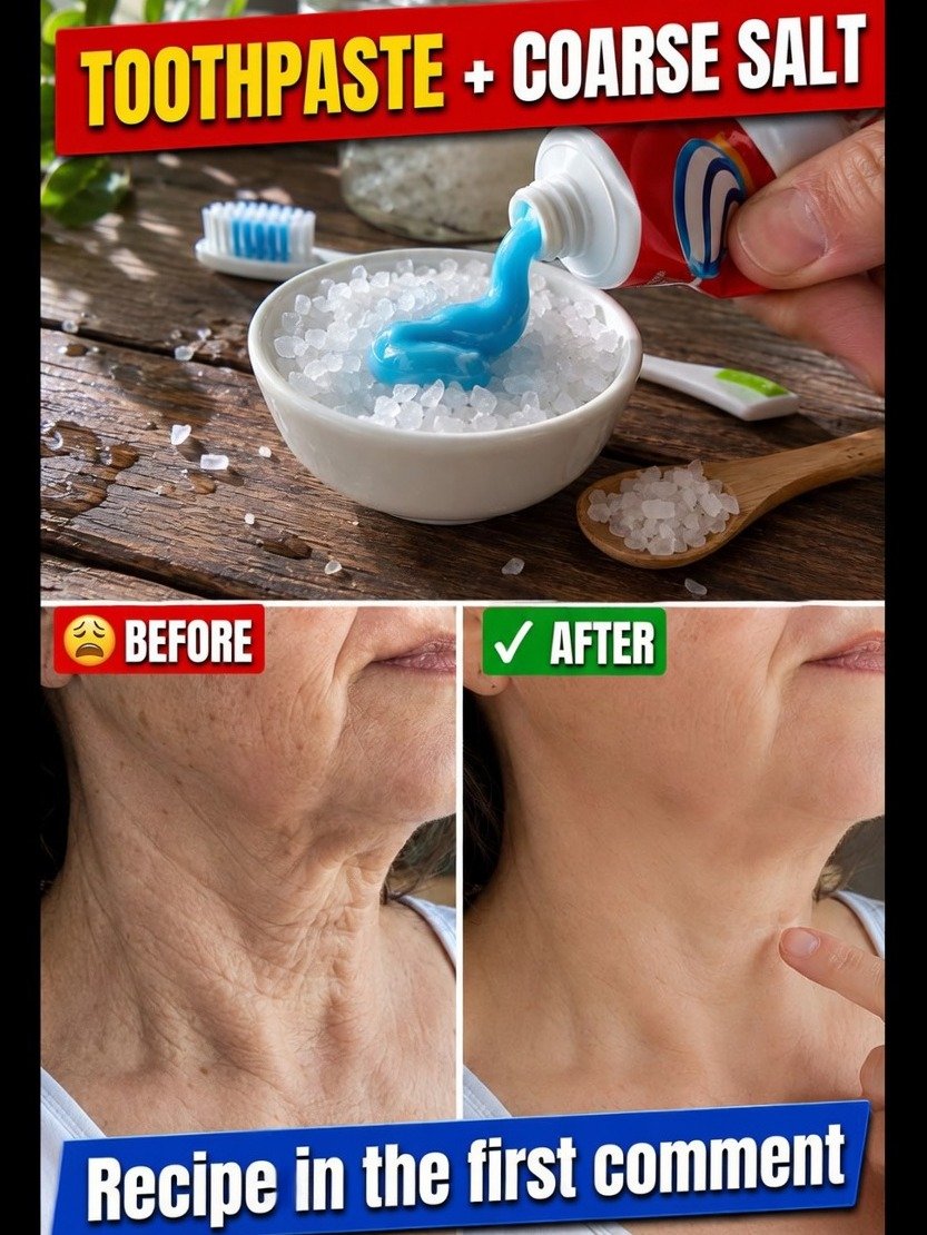My Skin Looked So Good, People Asked If I Had Surgery – Here's The Shocking Natural Secret!