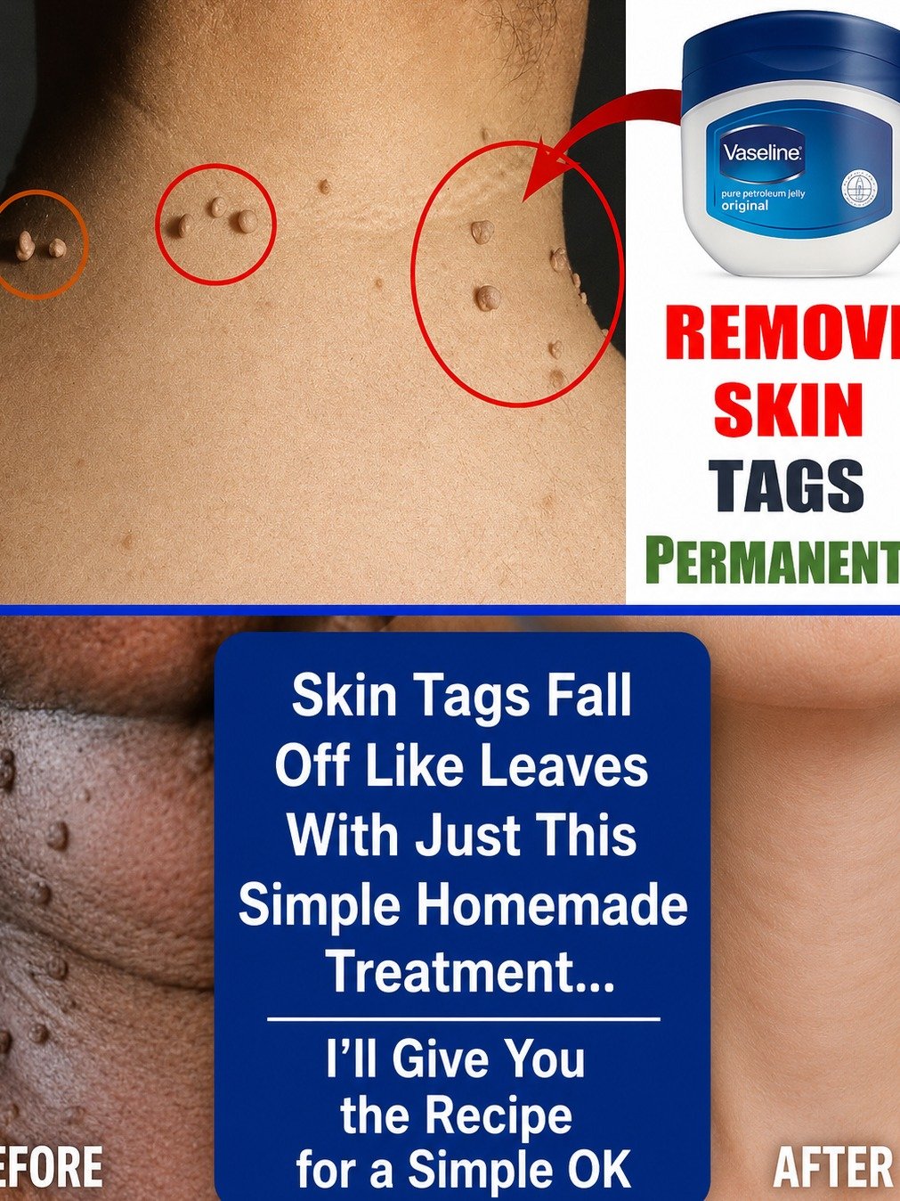 Warts Begone! 6 Shocking Natural Remedies That Could Transform Your Skin (Don't Miss Out!)