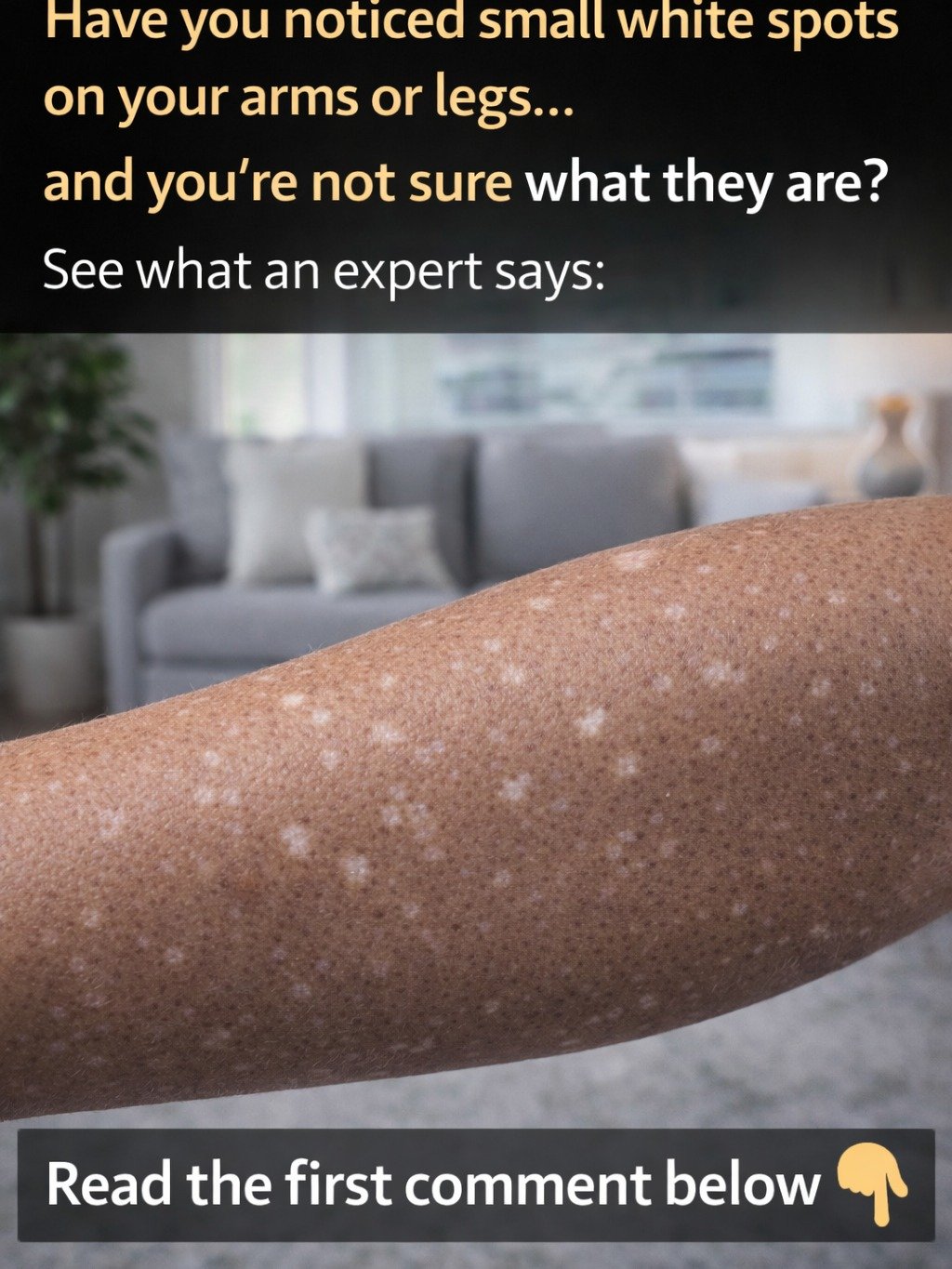 Unmasking White Spots: 5 Common Causes on Your Skin and When You ABSOLUTELY Need to See a Doctor