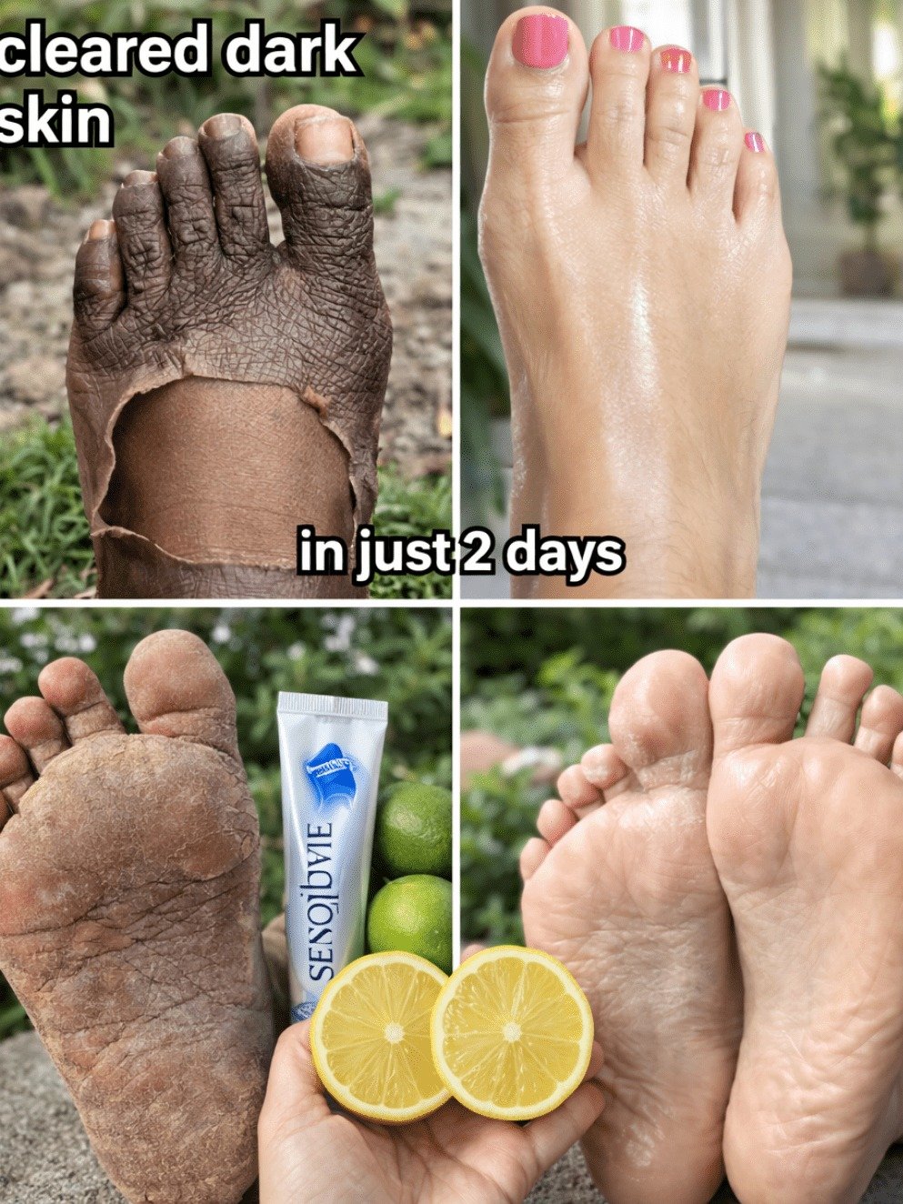 The 1 Unexpected Habit That Transformed My Legs: Get Smoother, Brighter Skin in Weeks!