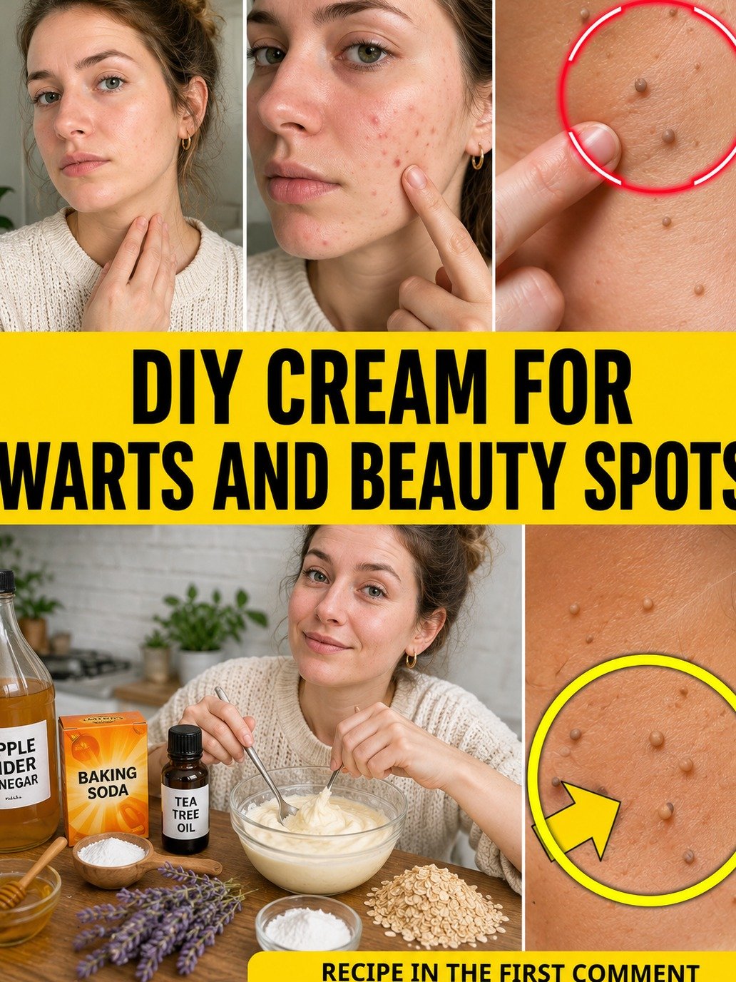 The Viral 3-Ingredient Skin Hack: Erase Warts & Blemishes Naturally (Don't Miss This!)