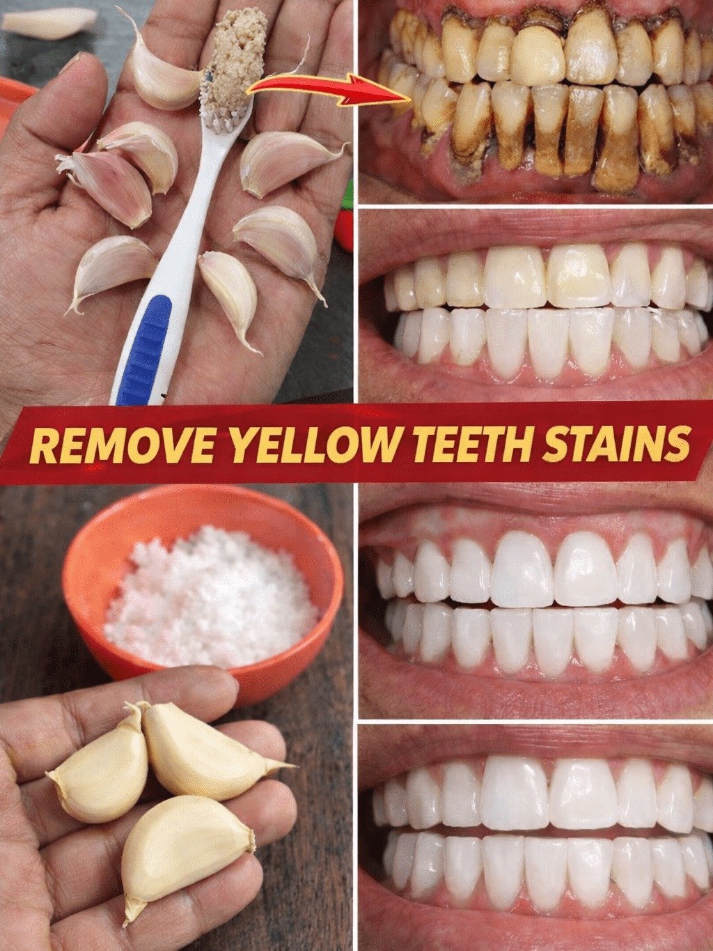 Unlock Your Whitest Smile: The 2-Ingredient Kitchen Hack Dentists WON'T Tell You About!