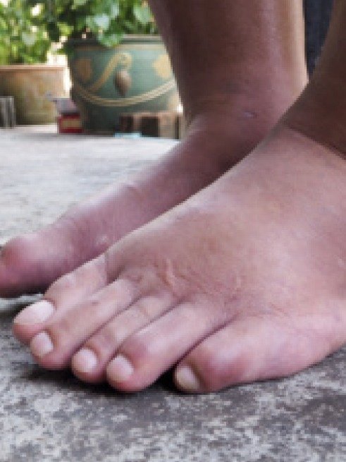 Your Kidneys Are Screaming: 7 Hidden Signs You CAN'T Afford To Ignore!