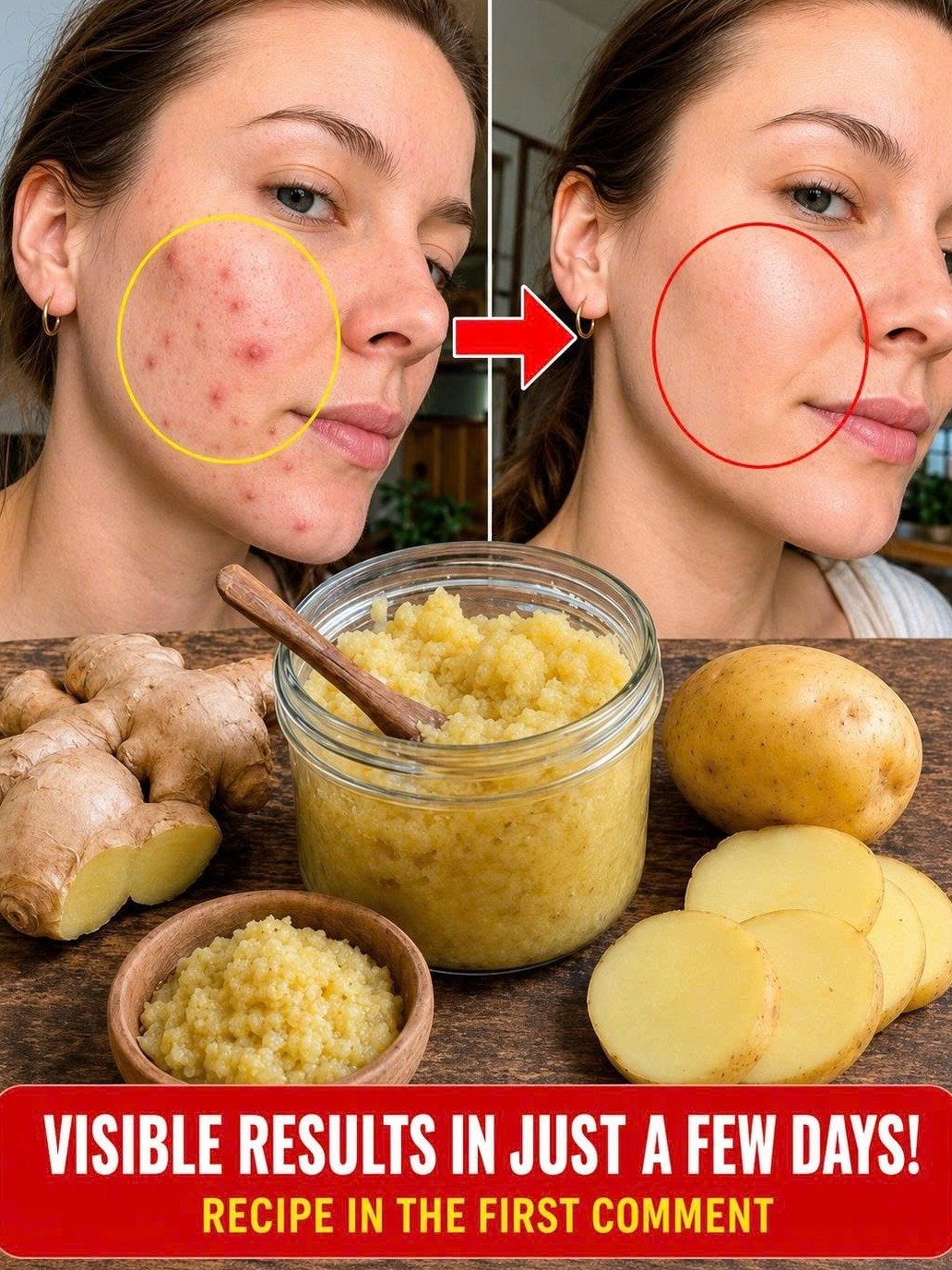 Unbelievable Skin Transformation: The Viral Potato & Ginger Hack from Your Kitchen (Don't Miss Out!)
