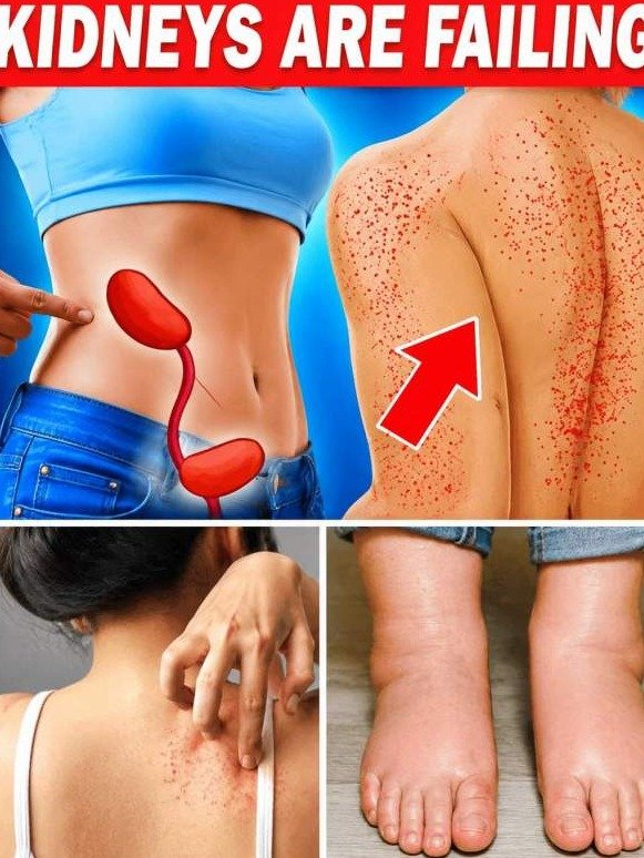 Your Kidneys Are Screaming for Help: 10 Hidden Signs You CANNOT Afford to Ignore!