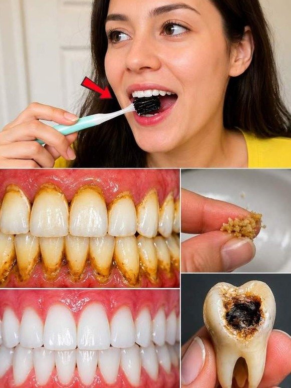 Dentists HATE These 9 Kitchen Secrets: How to STOP Cavities & Rebuild Enamel After 50
