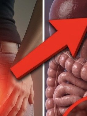 10 CRITICAL Colon Cancer Red Flags You Can't Afford to Ignore (Your Health Depends On It!)