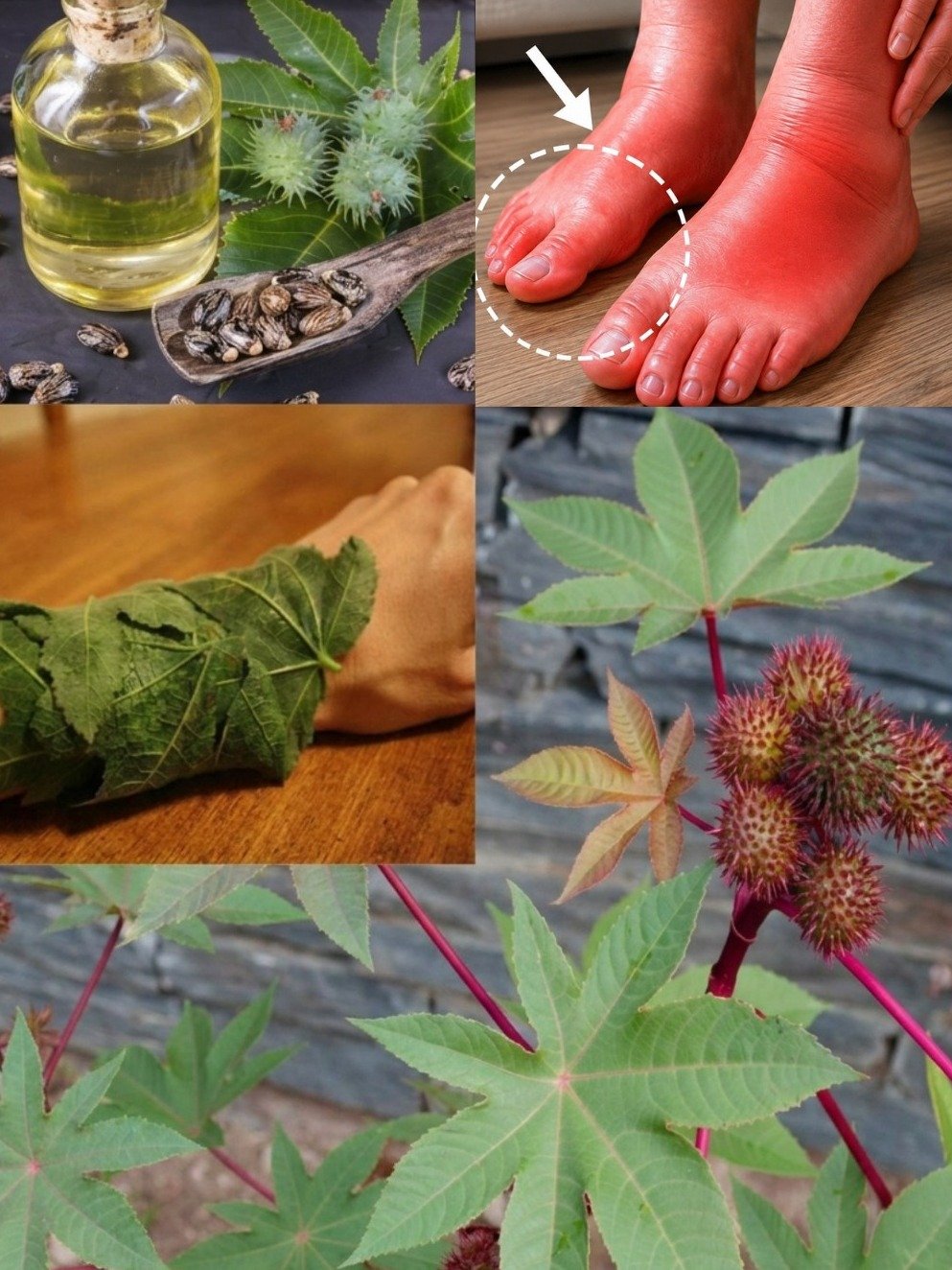 The ONE Ancient Secret for Swollen Joints People Wish They Knew Sooner! (Castor Oil & Leaf Compress Revealed)